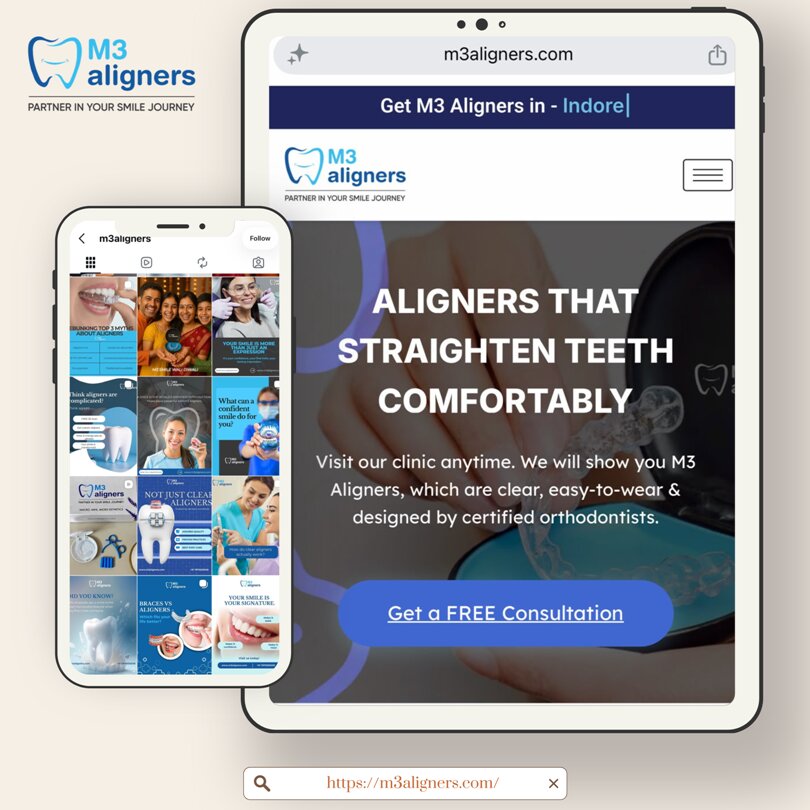 M3 Aligners